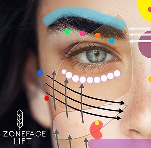 Zone Face Lift. zflimage small
